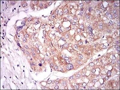 Immunohistochemistry: Tie-1 Antibody (8D12B10) - BSA Free [NBP2-37270]