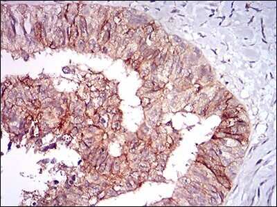 Immunohistochemistry: Tie-1 Antibody (8D12D2) - BSA Free [NBP2-37267]