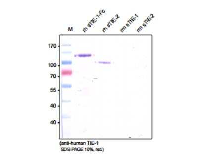 Western Blot: Tie-1 Antibody (6F12)Azide and BSA Free [NBP1-18610]