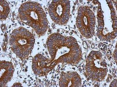 Immunohistochemistry-Paraffin: Tie-1 Antibody [NBP2-20635]