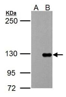 Western Blot: Tie-1 Antibody [NBP2-20635]