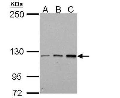 Western Blot: Tie-1 Antibody [NBP2-20635]