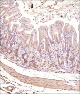 Immunohistochemistry-Paraffin: Tie-2 Antibody - BSA Free [NBP1-69753]