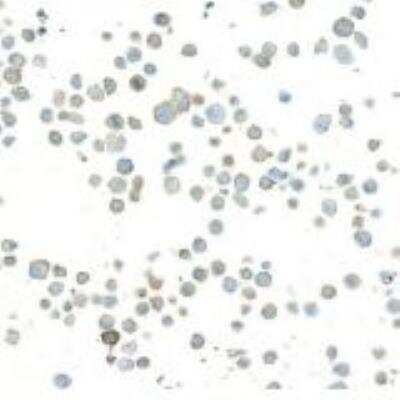 Immunocytochemistry/ Immunofluorescence: Tight Junction Protein 1 Antibody (BLR092G) [NBP2-80141]