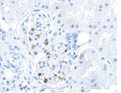Immunohistochemistry-Paraffin: Tight Junction Protein 1 Antibody (BLR092G) [NBP2-80141]