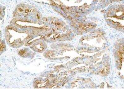 Immunohistochemistry-Paraffin: Tight Junction Protein 1 Antibody (BLR092G) [NBP2-80141]