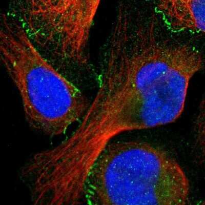 Immunocytochemistry/ Immunofluorescence: Tight Junction Protein 1 Antibody [NBP1-85046]