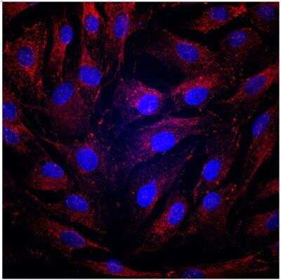 Immunocytochemistry/ Immunofluorescence: Tight Junction Protein 1 Antibody [NBP1-85047]