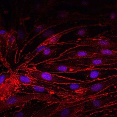 Immunocytochemistry/ Immunofluorescence: Tight Junction Protein 1 Antibody [NBP1-85047]