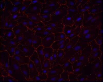 Immunocytochemistry/ Immunofluorescence: Tight Junction Protein 1 Antibody [NBP1-85047]