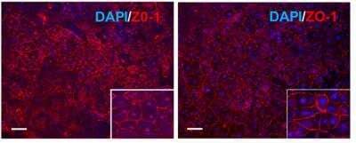 Immunohistochemistry: Tight Junction Protein 1 Antibody [NBP1-85047]