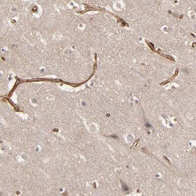 Immunohistochemistry-Paraffin: Tight Junction Protein 1 Antibody [NBP1-85046]