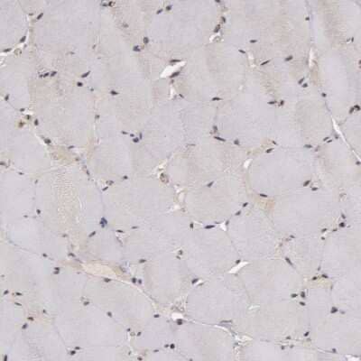Immunohistochemistry-Paraffin: Tight Junction Protein 1 Antibody [NBP1-85046]