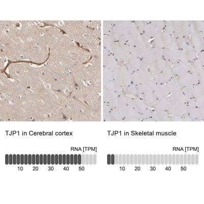 Immunohistochemistry-Paraffin: Tight Junction Protein 1 Antibody [NBP1-85046]