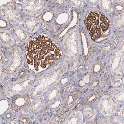 Immunohistochemistry-Paraffin: Tight Junction Protein 1 Antibody [NBP1-85047]