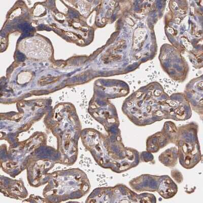 Immunohistochemistry-Paraffin: Tight Junction Protein 1 Antibody [NBP1-85047]