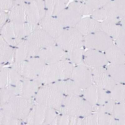 Immunohistochemistry-Paraffin: Tight Junction Protein 1 Antibody [NBP1-85047]
