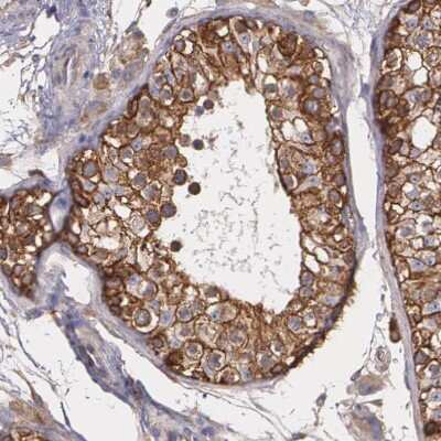 Immunohistochemistry-Paraffin: Tight Junction Protein 1 Antibody [NBP1-85047]
