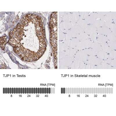 Immunohistochemistry-Paraffin: Tight Junction Protein 1 Antibody [NBP1-85047]