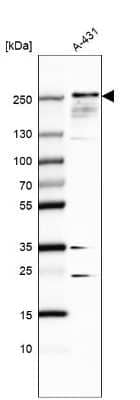 Western Blot: Tight Junction Protein 1 Antibody [NBP1-85047]