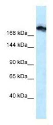 Western Blot: Tight Junction Protein 1 Antibody [NBP1-91621]