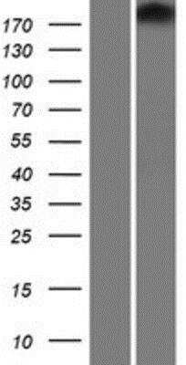 Western Blot: Tight Junction Protein 1 Overexpression Lysate [NBP2-10877]