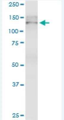 Western Blot: Tight Junction Protein 2 Antibody (4D12) [H00009414-M01-100ug]