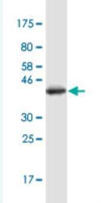 Western Blot: Tight Junction Protein 2 Antibody (4D12) [H00009414-M01-100ug]