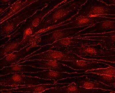 Immunocytochemistry/ Immunofluorescence: Tight Junction Protein 2 Antibody [NBP1-86850]