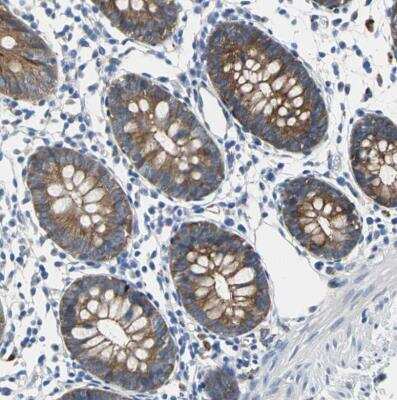 Immunohistochemistry-Paraffin: Tight Junction Protein 2 Antibody [NBP1-86850]