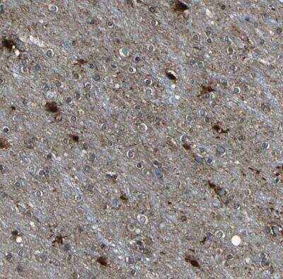 Immunohistochemistry-Paraffin: Tight Junction Protein 2 Antibody [NBP1-86850]