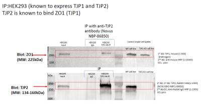 Immunoprecipitation: Tight Junction Protein 2 Antibody [NBP1-86850]