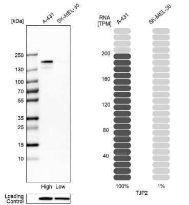 Western Blot: Tight Junction Protein 2 Antibody [NBP1-86850]