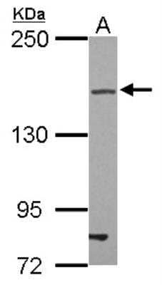 Western Blot: Tight Junction Protein 2 Antibody [NBP2-20641]