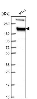 Western Blot: Tight Junction Protein 2 Antibody [NBP2-68905]