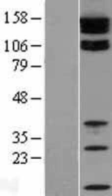 Western Blot: Tight Junction Protein 2 Overexpression Lysate [NBL1-16938]