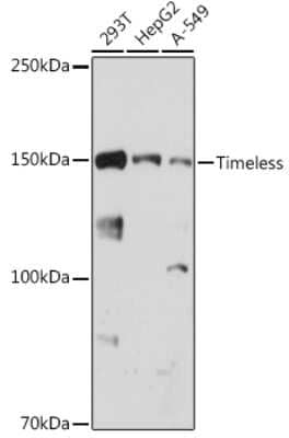 Western Blot: Timeless Antibody (6D4L2) [NBP3-15272]