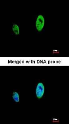 Immunocytochemistry/ Immunofluorescence: Timeless Antibody [NBP1-32404]