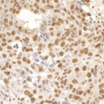 Immunohistochemistry: Timeless Antibody [NB100-40853]