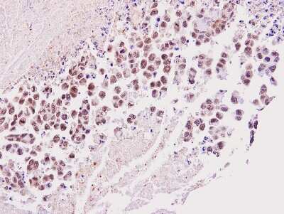 Immunohistochemistry-Paraffin: Timeless Antibody [NBP1-32404]