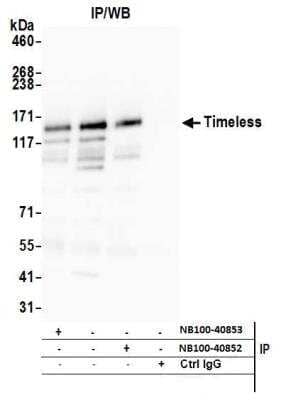 Western Blot: Timeless Antibody [NB100-40853]