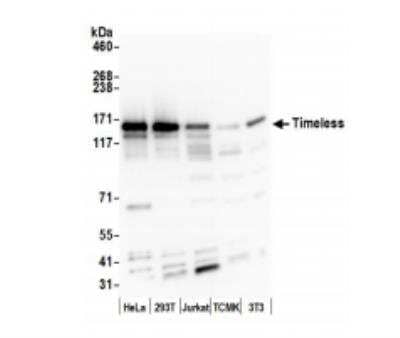 Western Blot: Timeless Antibody [NB100-40853]