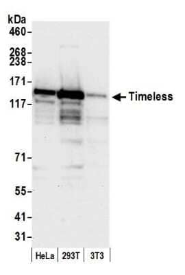 Western Blot: Timeless Antibody [NB100-40853]