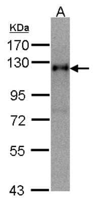 Western Blot: Timeless Antibody [NBP1-32404]