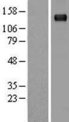 Western Blot: Timeless Overexpression Lysate [NBL1-16915]