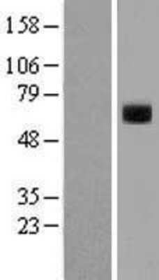 Western Blot: t-Plasminogen Activator/tPA Overexpression Lysate [NBL1-14484]