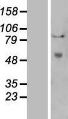 Western Blot: t-Plasminogen Activator/tPA Overexpression Lysate [NBL1-14485]