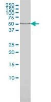 Western Blot: Tissue alpha-L-Fucosidase/FUCA1 Antibody (1D4) [H00002517-M01]