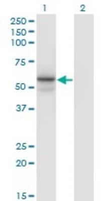 Western Blot: Tissue alpha-L-Fucosidase/FUCA1 Antibody (1D4) [H00002517-M01]