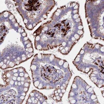 Immunohistochemistry: Tissue alpha-L-Fucosidase/FUCA1 Antibody [NBP2-32044]